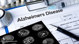 Alzheimer's disease, Alzheimer's disease signs and symptoms, Alzheimer's disease warning signs, Alzheimer's disease dementia, signs of dementia, world Alzheimer's day, indian express news