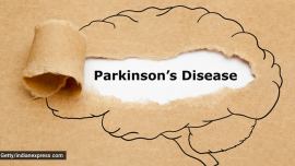 Deep Brain Stimulation, what is Deep Brain Stimulation, Deep Brain Stimulation surgery, Deep Brain Stimulation for Parkinson’s Disease, Parkinson’s Disease treatment, Parkinson’s Disease, what is Parkinson’s Disease, what causes Parkinson’s Disease, surgery for Parkinson’s Disease, indian express news