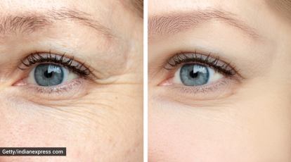 Yoga and skincare: Asanas to tighten skin around eyes, reduce wrinkles