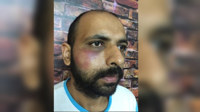In an FIR, the injured constable Varun Kapoor said the attackers threatened to teach him a lesson for reportedly leaking CCTV footage. (Express photo)