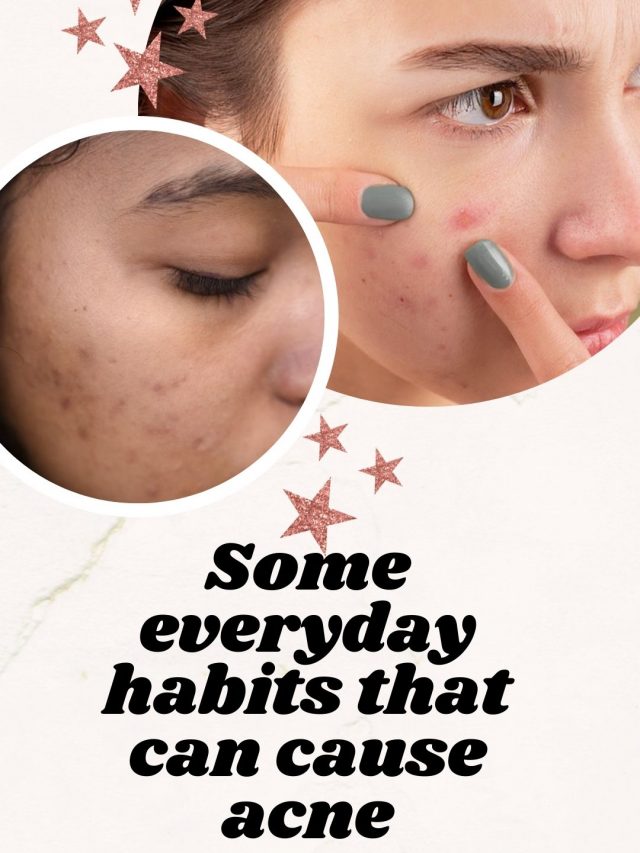 Some Everyday Habits That Can Cause Acne | The Indian Express