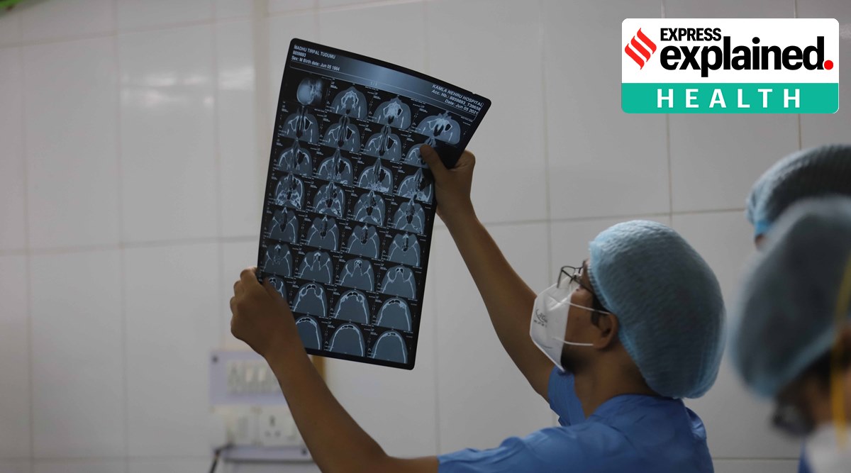 This study was conducted by an international team led by researchers at NCI, part of the NIH. (Express Photo/Representational)