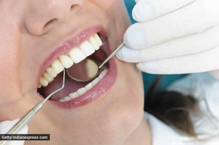 dental health, oral health, dental hygiene, oral hygiene, how to prevent cavities, what are cavities, how to protect teeth from cavities, indian express news