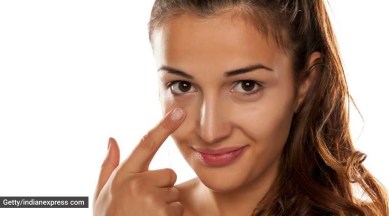 dark circles