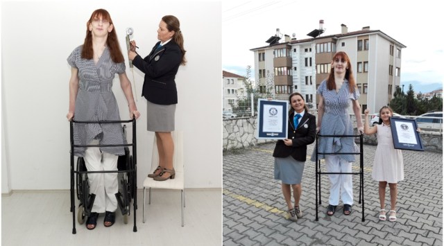 Rumeysa Gelgi, tallest woman livingm guinness records, guinness records 2022, indianexpress.com, indianexpress, tallest woman living guinness, Rumeysa Gelgi rare condition, weaver's syndrome,
