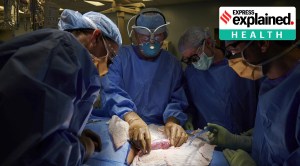 Explained: How surgeons gave pig kidney to a human