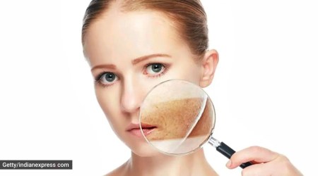 steaming, why steaming is essential, skincare, skincare tips, dermatologist, indianexpress.com, indianexpress, facial steaming, steaming benefits for skin,