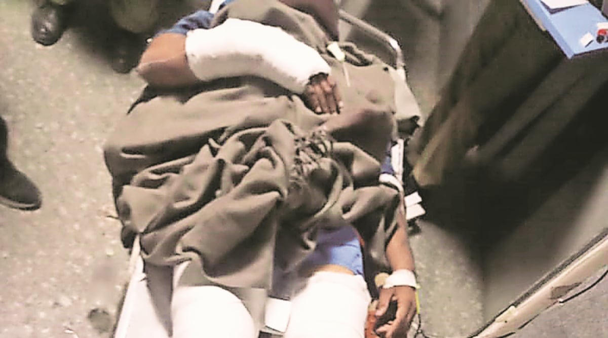 Nails were pierced into Amra Ram Godara's legs