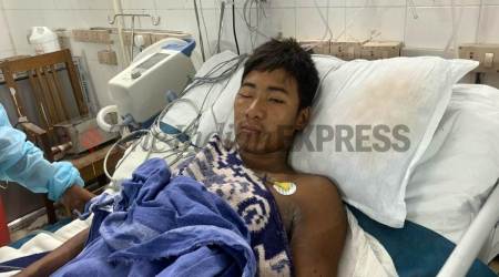 Sheiwang at the Assam Medical College and Hospital in Dibrugarh Tuesday. (Express photo by Tora Agarwala)