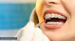 gums, gum health, gum bleeding, home remedies for gum bleeding, how to stop gums from bleeding, oral health, dental hygiene, indian express news