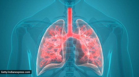 lung damage