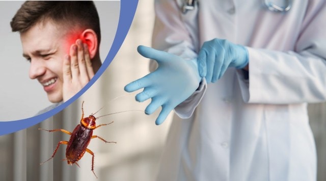 cockroach in ear, doctor extract cockroach from ear, blocked ear turned to be roach, nz man block ear cockroach, odd news, indian express