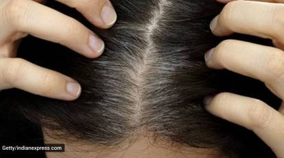 Expert shares effective Ayurvedic remedies to reverse premature greying of  hair | Lifestyle News,The Indian Express