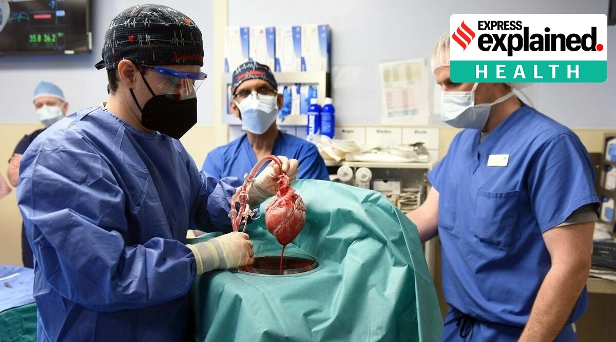 Members of the surgical team at University of Maryland School of Medicine show the pig heart for transplant into patient David Bennett in Baltimore on Friday. (AP)