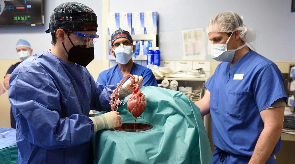 Members of the surgical team at University of Maryland School of Medicine show the pig heart for transplant into patient David Bennett in Baltimore on Friday. (Photo: AP)