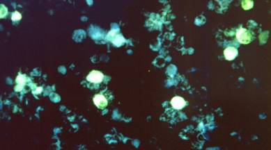 Cells infected with Epstein-Barr