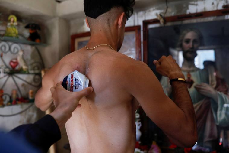 Christian Enmanuel Castellanos, Guinness World Record, scapulas,