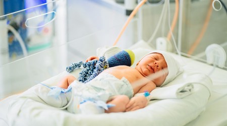 Preterm birth complications are the leading cause of death among children under 5 years of age, responsible for approximately 1 million deaths.