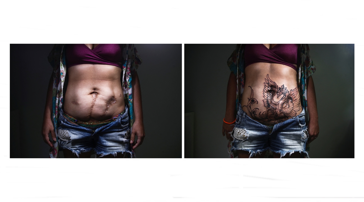 Turning trauma into art, Brazilian tattoo artist gives women reason to  smile | Lifestyle News,The Indian Express