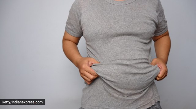 World Obesity Day, World Obesity Day 2022, obesity, being obese, health risks obesity, obesity surgery, weight loss surgery, bariatric surgery, indian express news