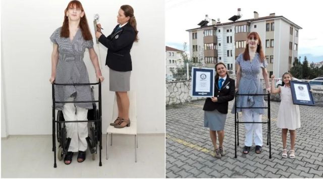 World’s tallest woman, Woman with longest hands and fingers, woman with the world’s longest back, Guinness world record tallest woman, Rumeysa Gelgi Guinness world record, Indian Express