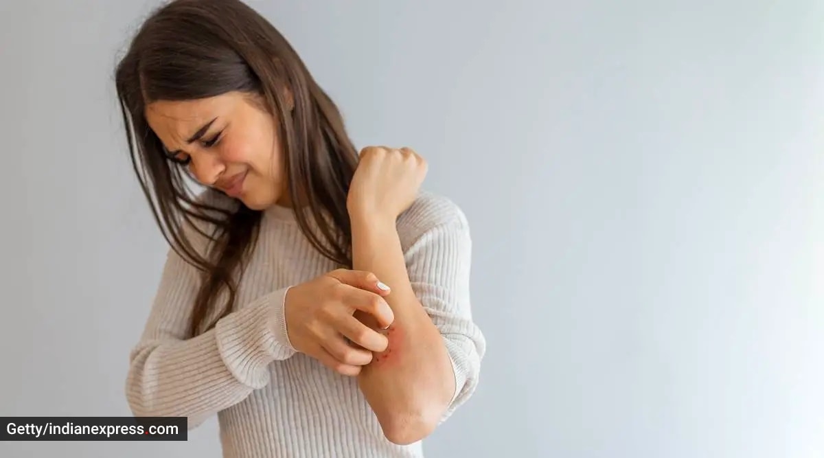 Tinea Corporis Infection High-Res Stock Photo - Getty Images