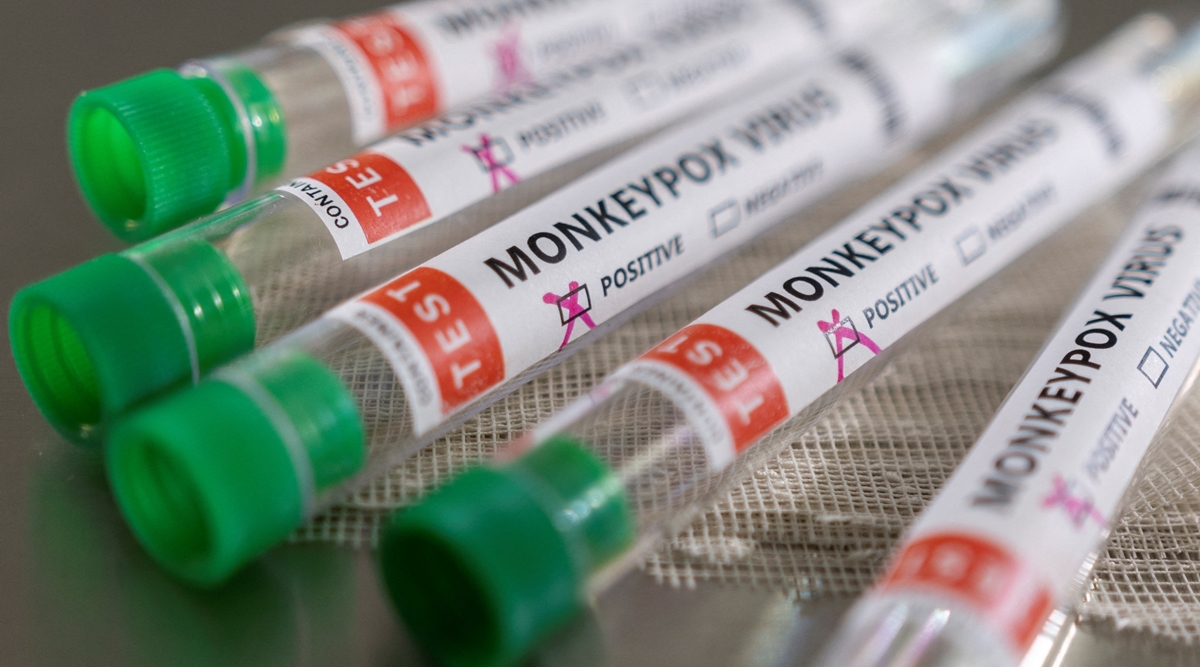Test tubes labelled "Monkeypox virus positive" are seen in this illustration. (Reuters)
