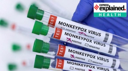 Monkeypox: A look at the infection and the risks for Indians