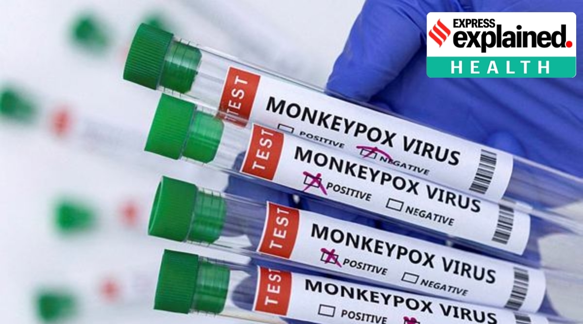  Test tubes labelled "Monkeypox virus positive and negative" are seen in this illustration taken May 23, 2022. (Reuters)