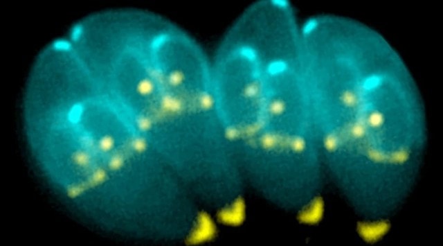 toxoplasma
