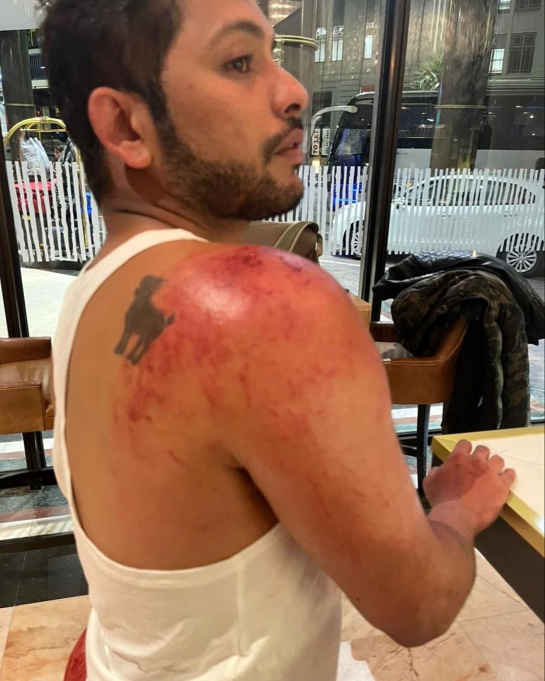 Nishant Bhat gets bitten by a crab and pig in Khatron Ke Khiladi 12