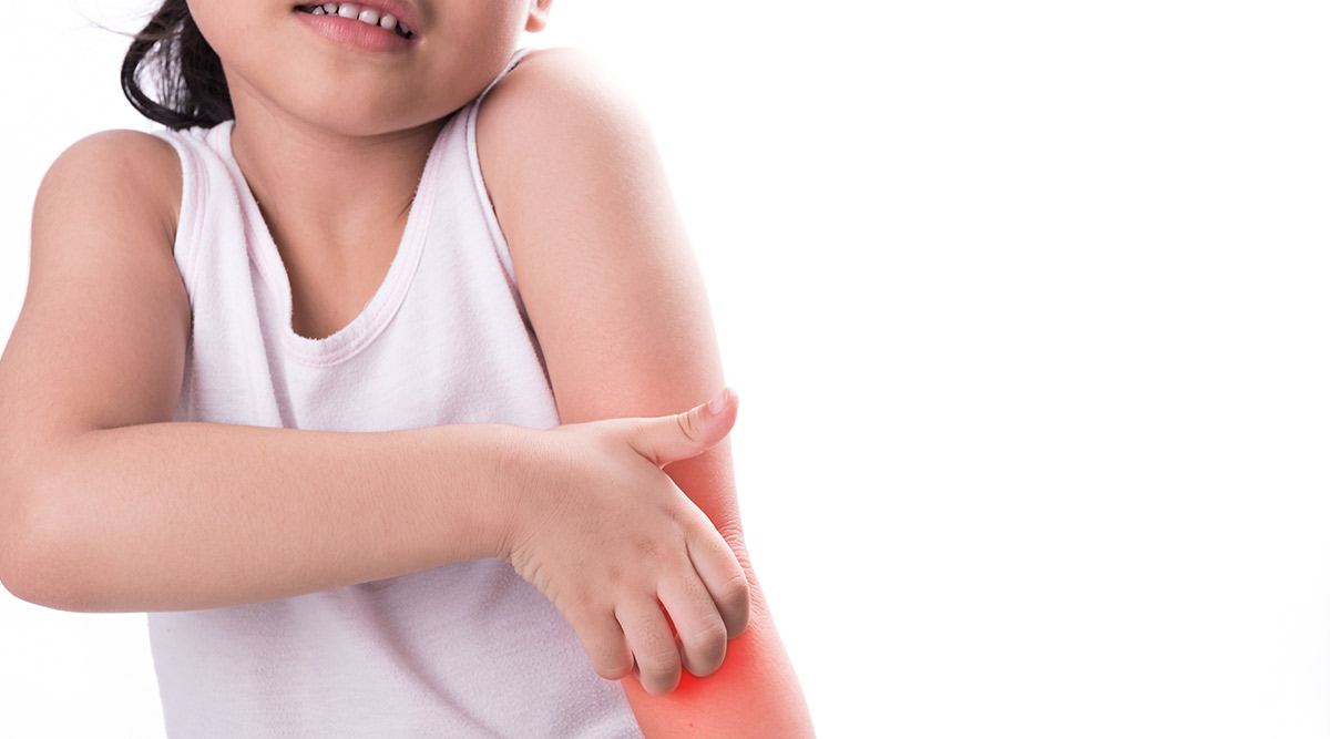 Skin Allergies In Children – What parents need to know?