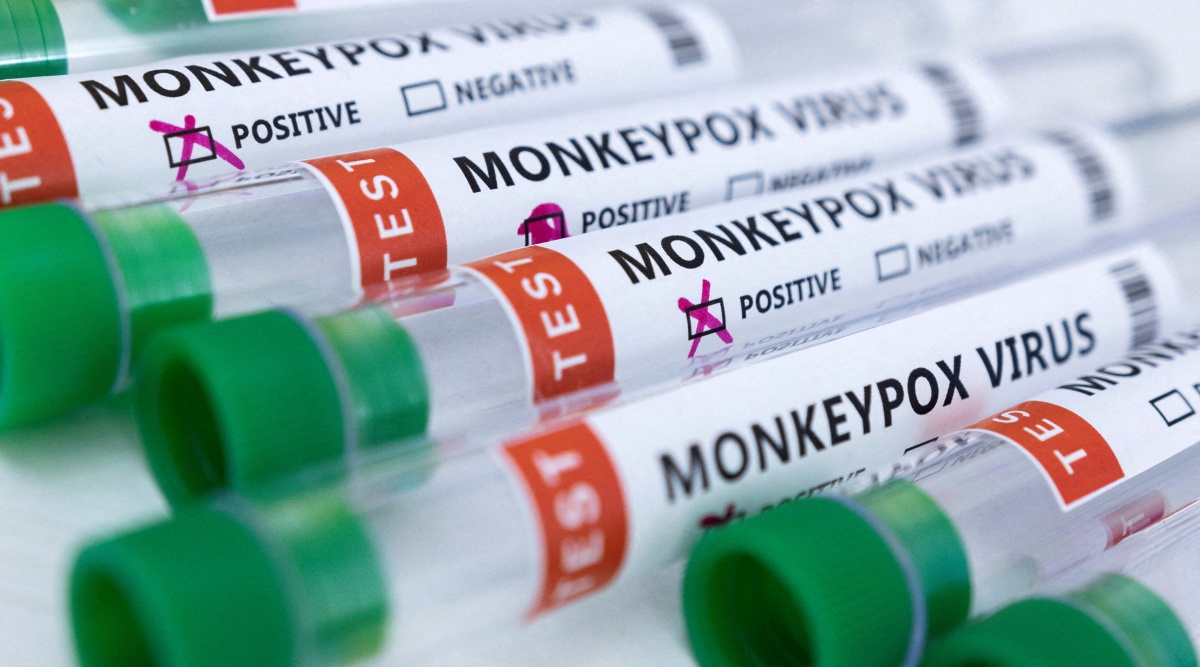 Doctors are being asked to test for monkeypox in the United States, while the CDC believes the danger to the public is low.