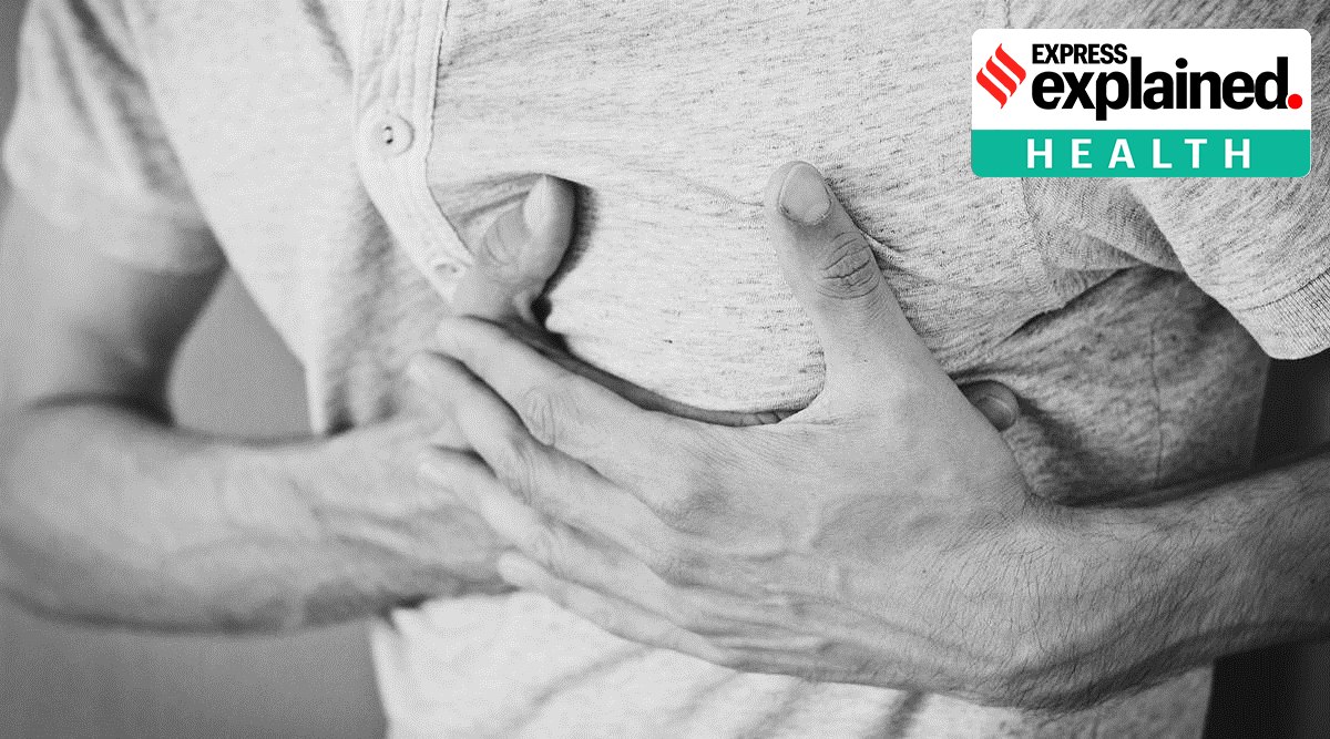 Data provided by the Brihanmumbai Municipal Corporation (BMC) showed that in 2019, a total of 5,849 patients lost their lives to heart attack in Mumbai. (Pixabay Photo/File)