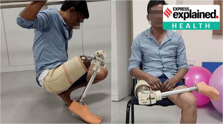 prosthetic leg indian IIT guwahati