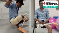 prosthetic leg prosthetic leg indian IIT guwahati