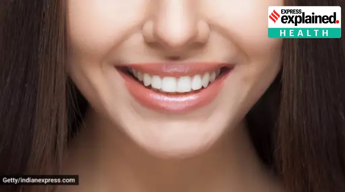 While braces are made of metal or porcelain and are attached to the patient’s teeth, aligners are made of plastic and are custom made to fit the teeth. (Photo: Getty/Thinkstock)