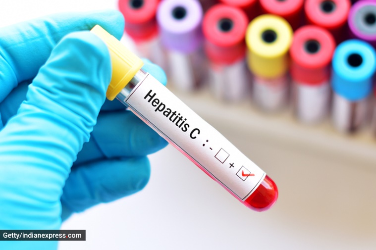 World Hepatitis Day 2022, Hepatitis C, types of Hepatitis, what does Hepatitis C do, Hepatitis symptoms, Hepatitis C and digestive issues, indian express news