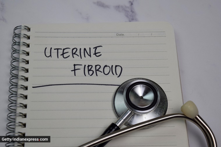 Fibroid Awareness Month, Fibroid Awareness Month 2022, uterine fibroids, what are uterine fibroids, treatment uterine fibroids, symptoms of uterine fibroids, causes of uterine fibroids, women health, indian express news