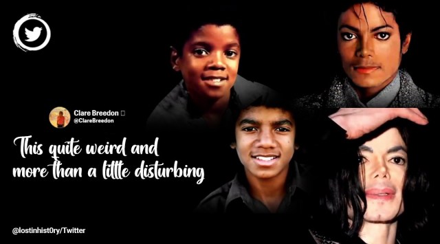 Michael Jackson’s face evolution, Michael Jackson plastic surgery, Michael Jackson nose job, Michael Jackson race, Michael Jackson vitiligo and lupus, MJ Michael Jackson, Indian Express