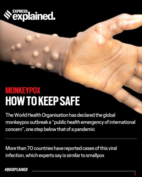 Monkeypox, What is monkeypox, monkeypox in india, monkeypox symptoms, monkeypox treatment