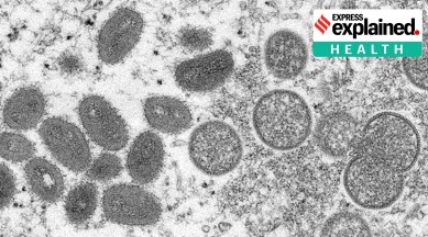 monkeypox, monkey pox kerala, what is monkey pox, monkey pox symptoms, express explained, indian express