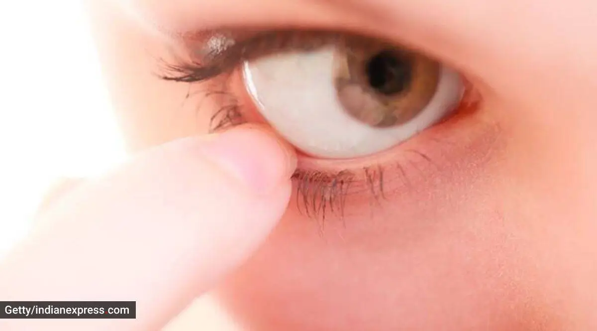 White spot on eye: Causes, symptoms, and treatment