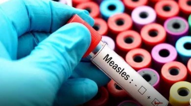 Gurgaon, nuh village Gurgaon, Gurgaon latest news, cases of measles in Gurgaon, Gurgaon latest news, Indian Express