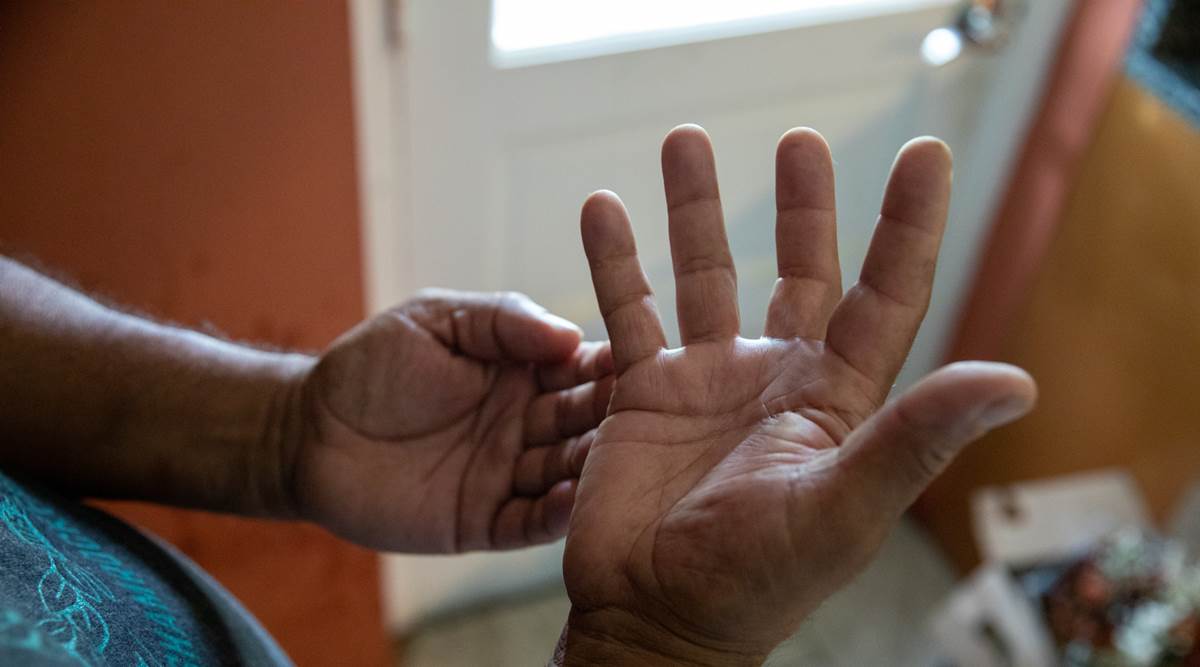 Moises Ferrera shows his right hand that has lost mobility after migrant smugglers hit it repeatedly with a hammer in an attempt to extort more money from his family, in Maryland, (Amanda Andrade-Rhoades/The New York Times)