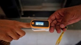 Skin Pigmentation, white people and people of color