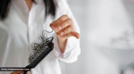hair loss, hair fall, hair thinning, what causes hair loss, what causes hair fall, reasons for hair loss, hair care and diet, health reasons for hair loss, hormonal issues, indian express news
