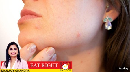 acne, gut health