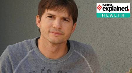 Vasculitis | Actor Ashton Kutcher | Vasculitis Explained