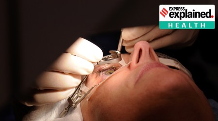 New surgical method was used by the researchers on study subjects in India and Iran, where there is a scarcity of donated corneas. (Getty Images)